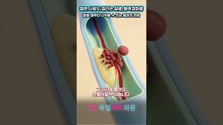 EP17 젊은 사람도 걸리는 질병, 동맥경화증!