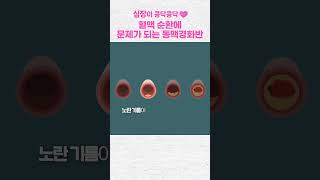 혈관 나이 젊게 만들어야 동맥경화반 예방!