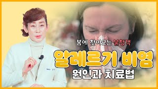 봄에 찾아오는 불청객 '알레르기 비염' [독일하트의원]