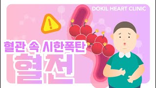 '이것'이 나타나면 혈전이 존재하는 신호! [독일하트의원]
